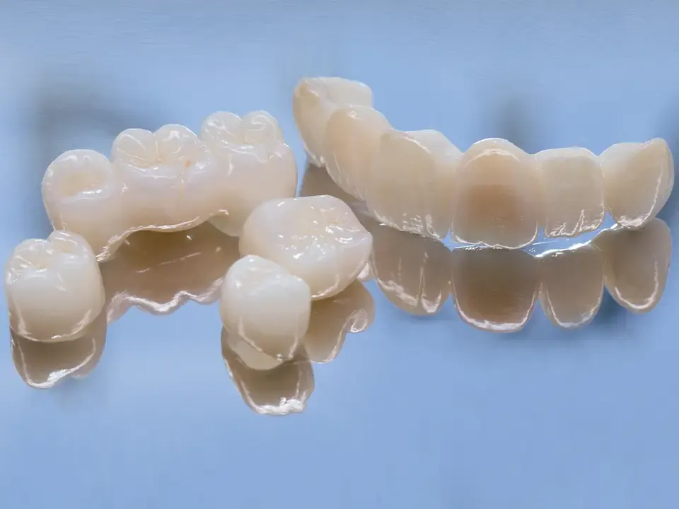 Custom ceramic crowns