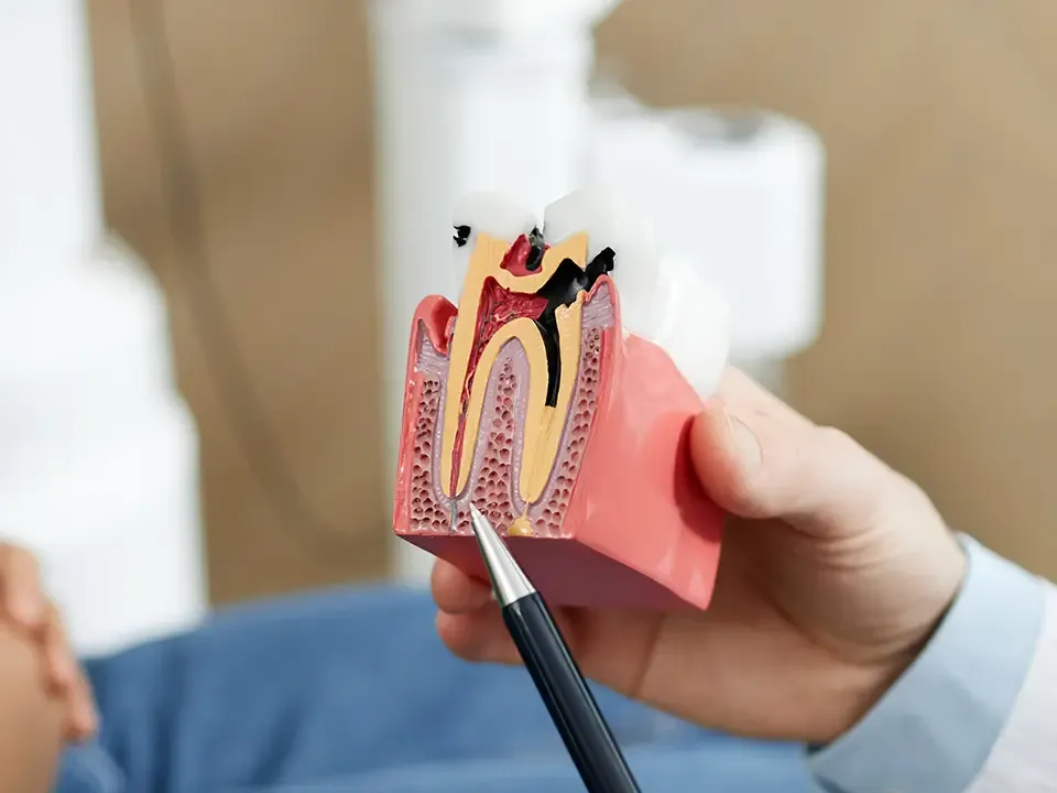 Tooth model showing the root canals